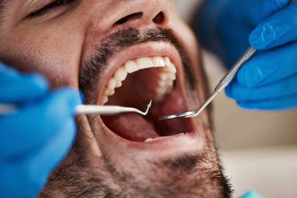 Best Emergency Treatment for Dental Infections or Abscesses in East Kapolei, HI